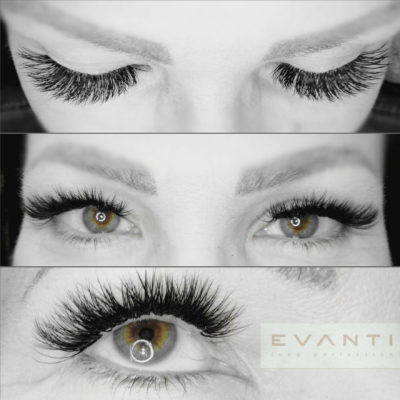 evanti_galerie_rasy2
